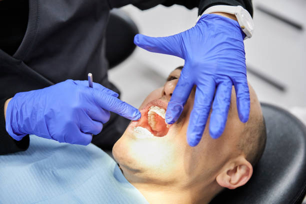 Best Emergency Treatment for Oral Infections in Columbus, MS